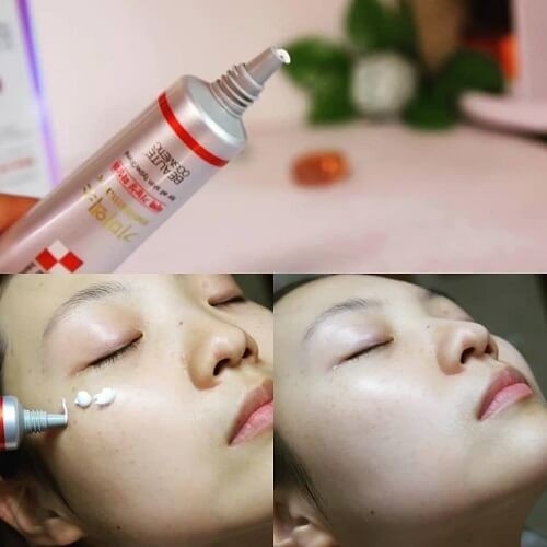 Kem Trị Nám Tàn Nhang Melasma-X 3D Whitening Clinic 35ml