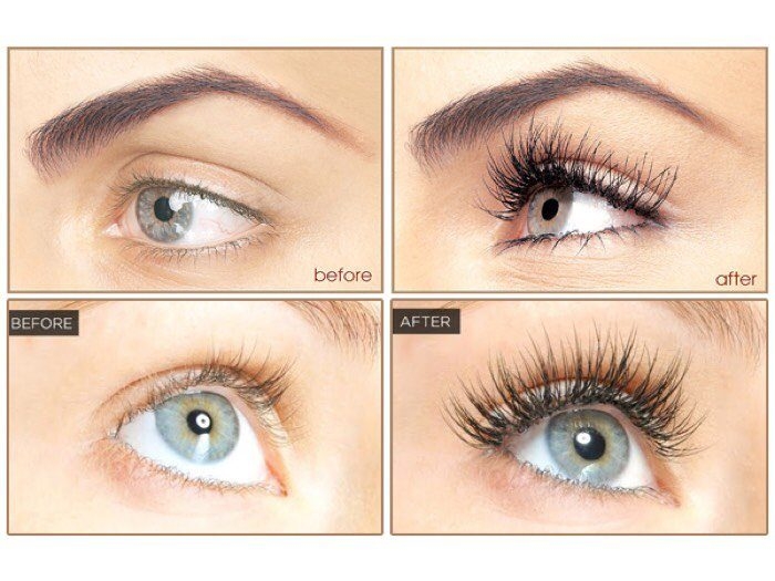Huyết Thanh Dưỡng Dài Mi Eveline 8 In 1 Total Action Concentrated Eyelash Serum 10ml