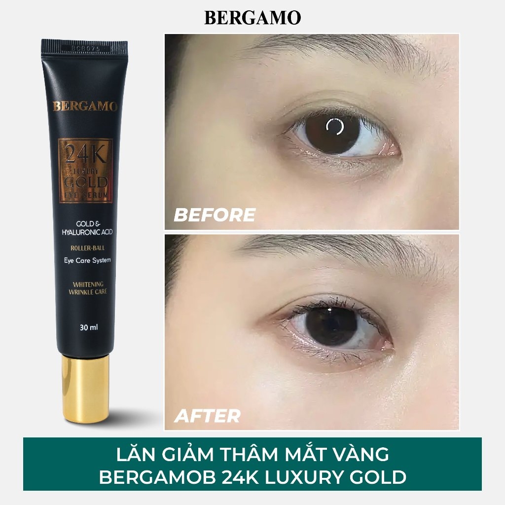 Lăn Giảm Thâm Mắt Vàng Bergamo 24k Luxury Gold Eye Serum 30ml