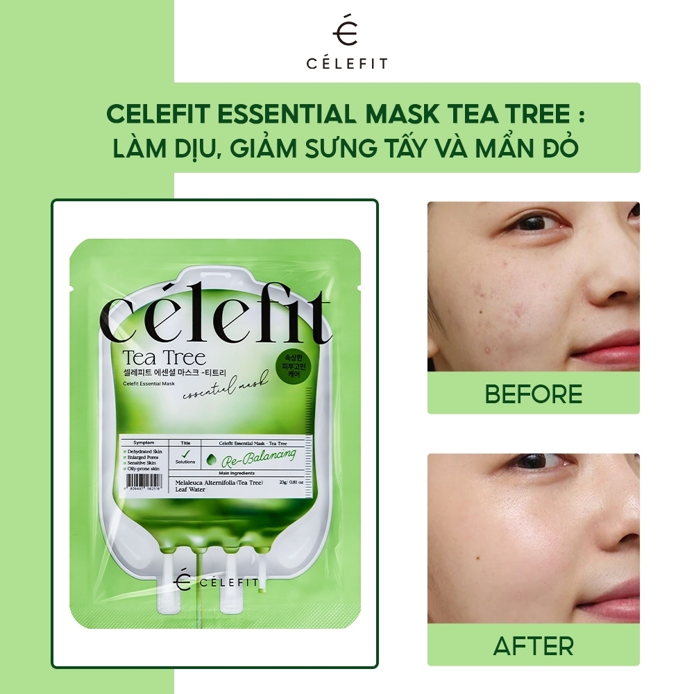 Mặt Nạ Cấp Ẩm, Dưỡng Da Celefit Essential Mask 23g
