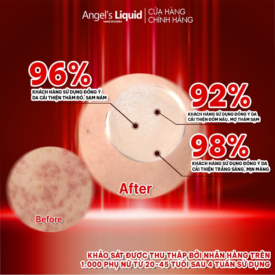 Siêu Tinh Chất Xoá Thâm Đỏ, Mờ Sạm Nám Angel's Liquid Tranexamic Mela Ampoule 30ml