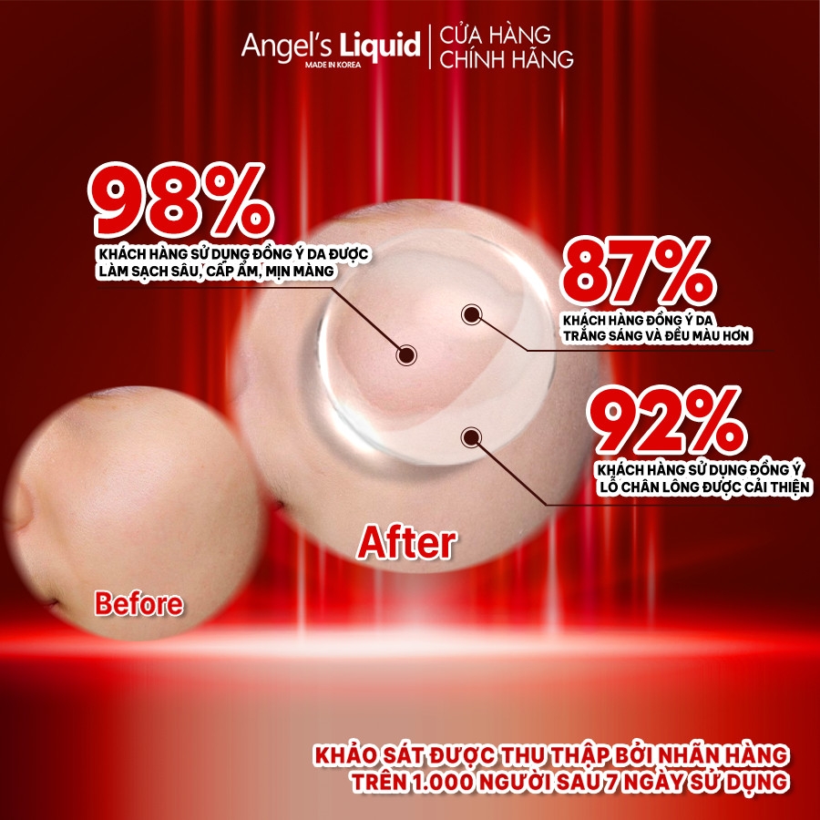 Nước Thần Làm Trắng Da, Dưỡng Da Toàn Diện Angel's Liquid Tone Up Whitening Program Treatment Essence 150ml