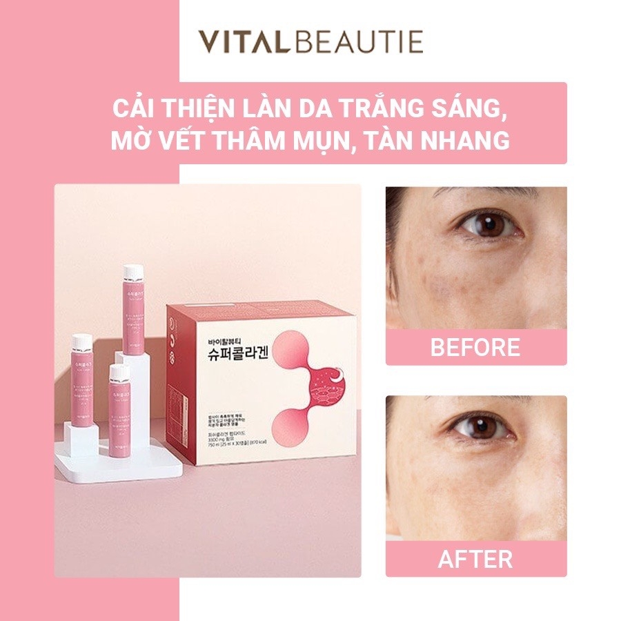 Nước Uống Bổ Sung Collagen Hỗ Trợ Làm Đẹp Và Ngăn Ngừa Lão Hóa Vital Beautie Super Collagen 25ml*30 ống