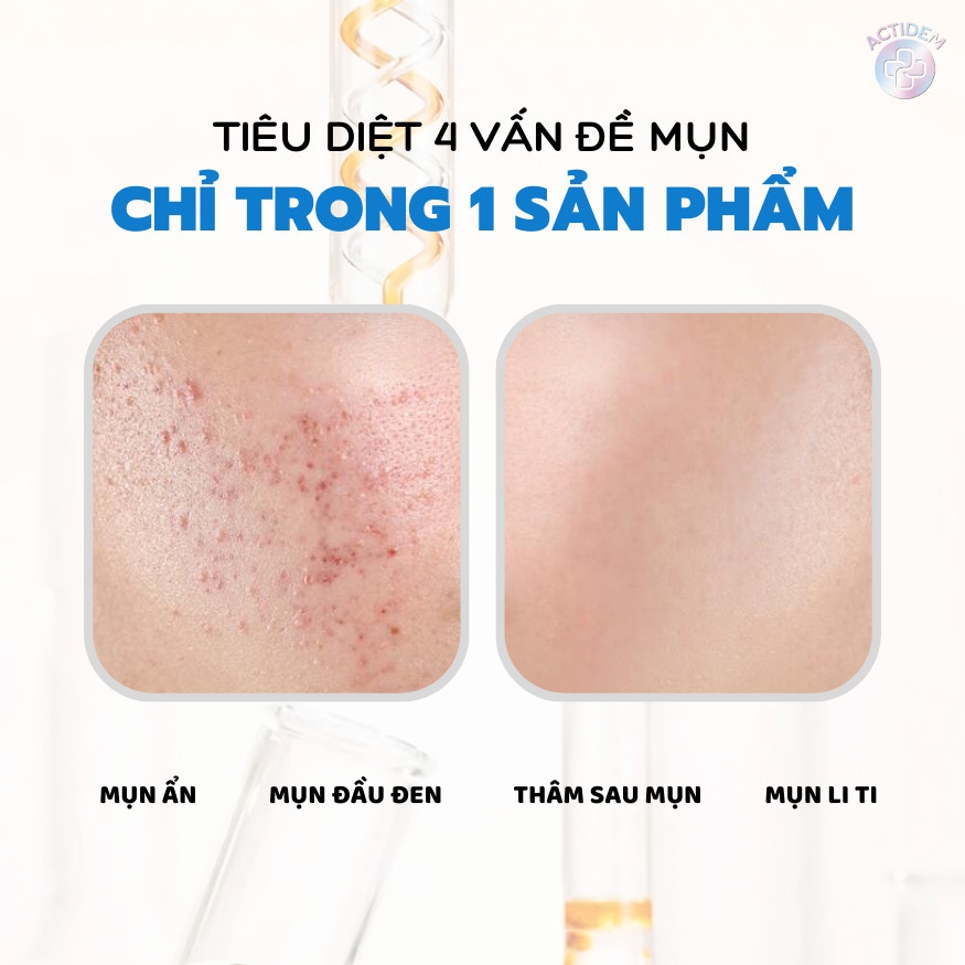 Kem Trị Mụn, Thâm Actidem Derma Gel 18g