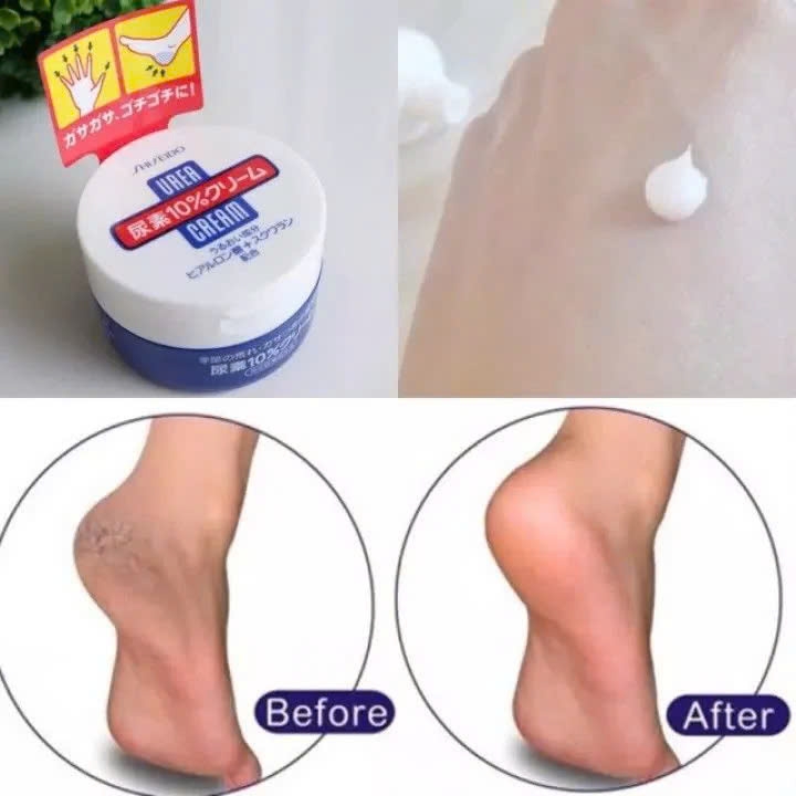 Kem Dưỡng Trị Nứt Nẻ Tay Chân Shiseido Urea Cream 100g