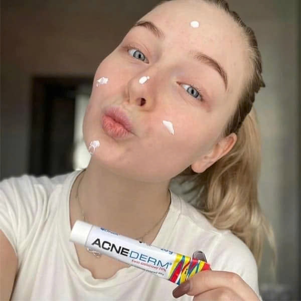 Kem Trị Mụn, Mờ Thâm Acne-Derm Kwas Azelainowy 20% 20g