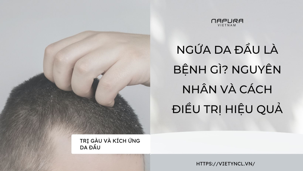Ngứa da đầu là bệnh gì? Nguyên nhân và cách điều trị hiệu quả