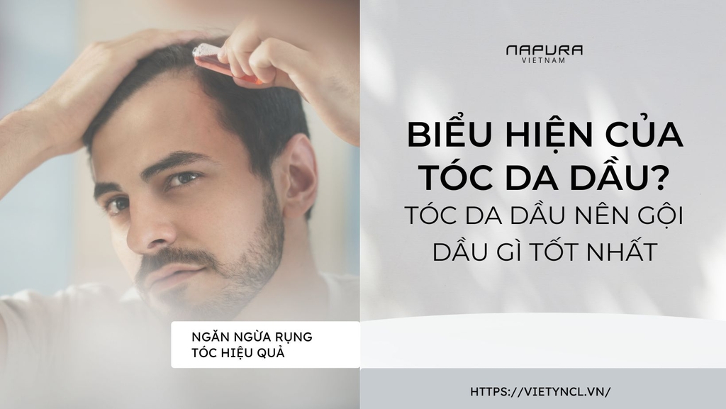 Biểu hiện của tóc da dầu? Tóc da dầu nên gội dầu gì tốt nhất