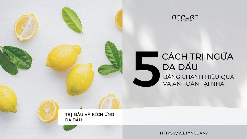 5 cách trị ngứa da đầu bằng chanh hiệu quả và an toàn tại nhà
