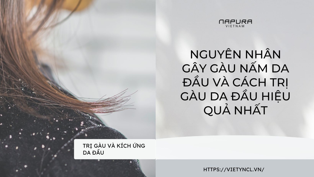 Nguyên nhân gây gàu nấm da đầu và cách trị gàu da đầu hiệu quả nhất