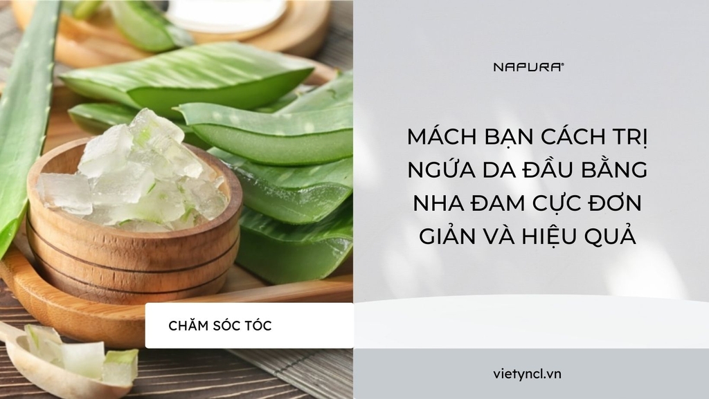 Mách bạn cách trị ngứa da đầu bằng nha đam cực đơn giản và hiệu quả