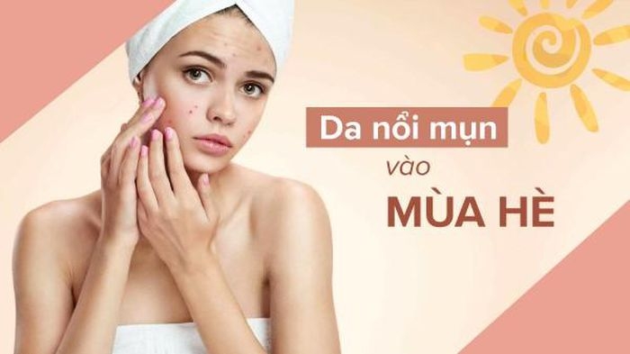 5 sai lầm khiến da bạn nổi mụn vào mùa hè và cách phòng tránh