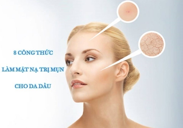 8 công thức làm Đắp mặt nạ trị mụn cho da dầu tại nhà giảm mụn tức thì