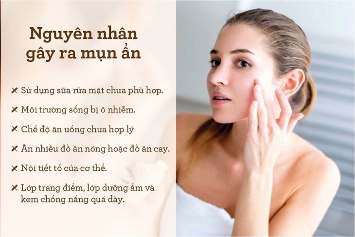 Những nguyên nhân gây mụn ẩn và các bước chăm sóc da mụn ngày hè