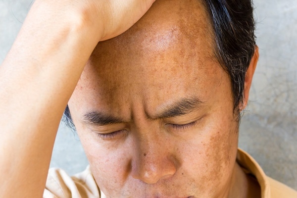 Bật mí cách làm trắng da cho nam tại nhà