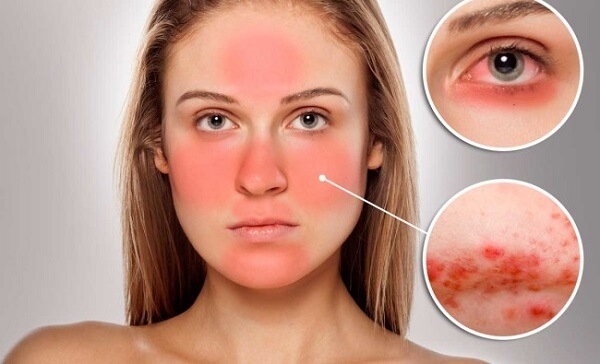 Kem trộn – cách nhận biết và tác hại của chúng