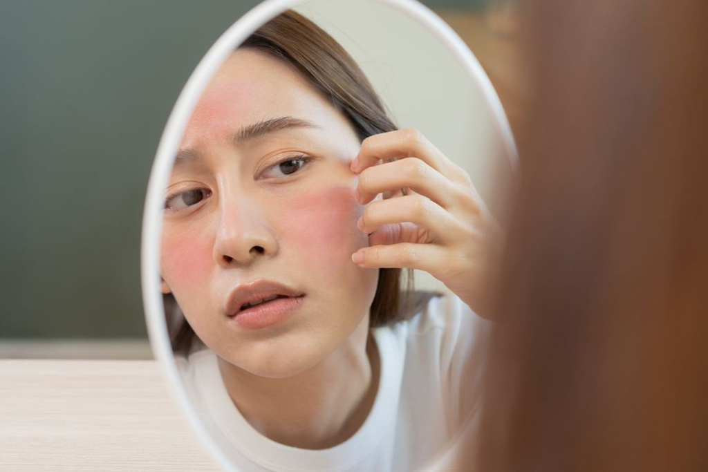 Da Rửa Mặt Xong Bị Căng Rát Phải Làm Sao?