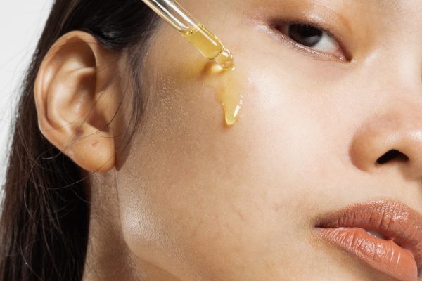 Da Giãn Mao Mạch Là Hiện Tượng Gì? Bạn Cần Chăm Da Như Nào Trong Tình Trạng Này?