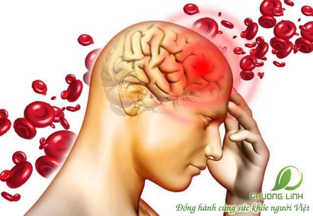 Những kiến thức về bệnh thiếu máu chắc chắn bạn không nên bỏ qua