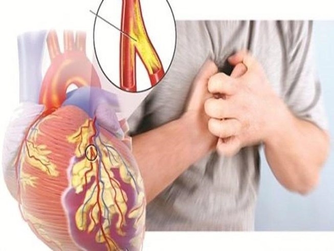 Dấu Hiệu Cần Đi Khám Tim Mạch Ngay