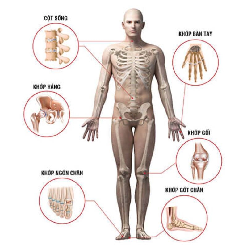 Các bệnh xương khớp thường gặp