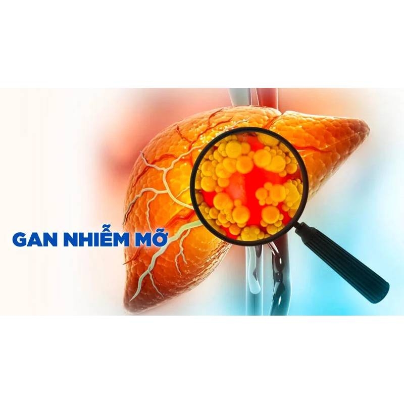 Cách cải thiện tình trạng gan nhiễm mỡ