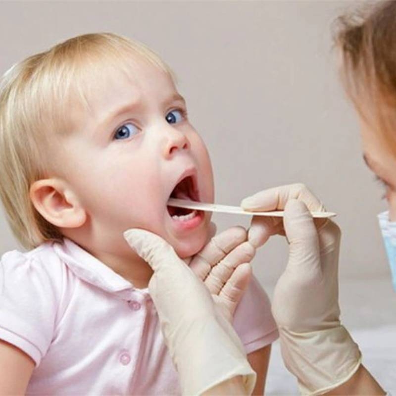 Mùa hè trẻ em dễ bị viêm họng làm sao để phòng tránh?
