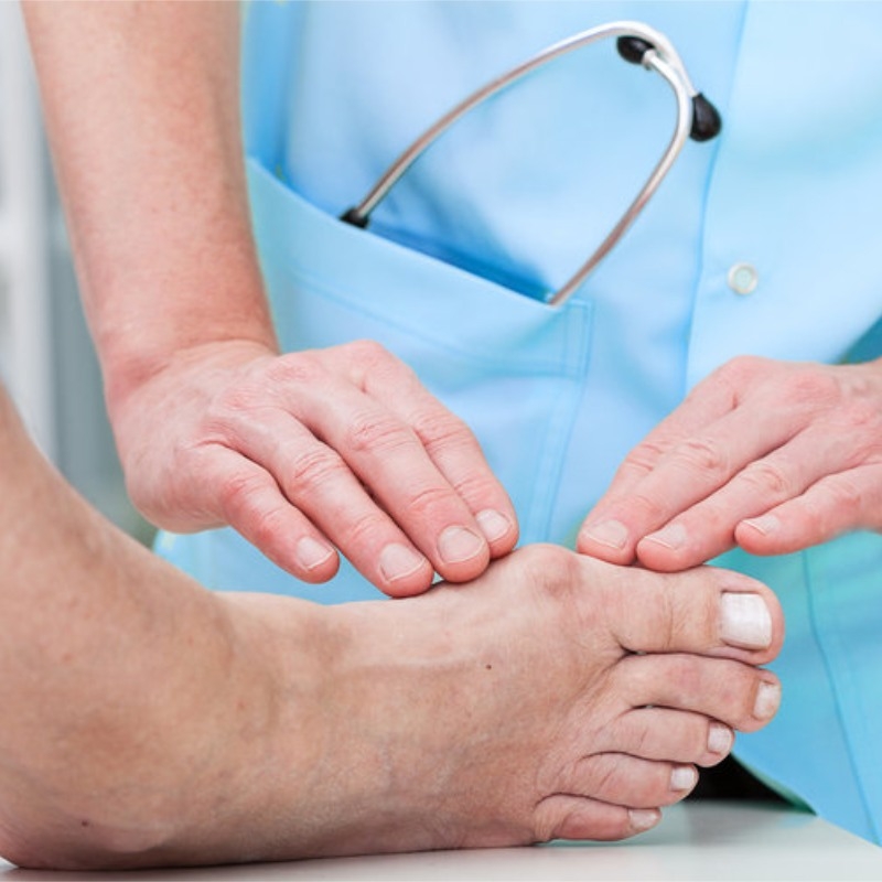 Những sai lầm thường gặp ở người bệnh gout