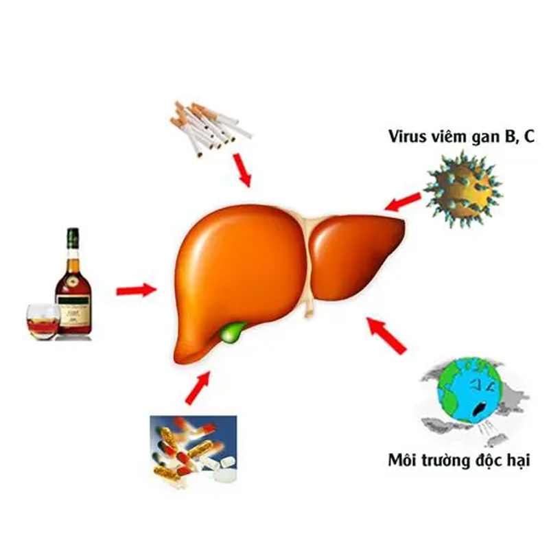 Nguyên Nhân Và Biểu Hiện Của Suy Giảm Chức Năng Gan