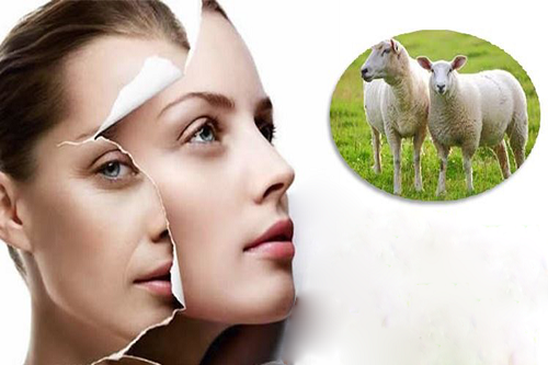 Tại sao serum nhau thai cừu được dùng nhiều ở Việt Nam
