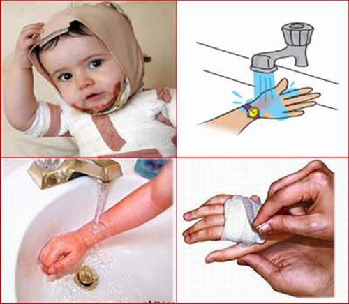 Những tai nạn thường gặp ở trẻ dịp hè