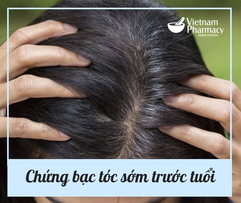 BẠC TÓC SỚM (Premature Graying)