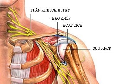 Viêm quanh khớp vai - Không thể coi thường