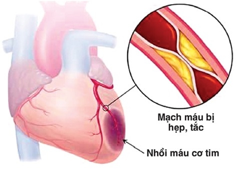 Trị chứng tâm dương hư ở người cao tuổi