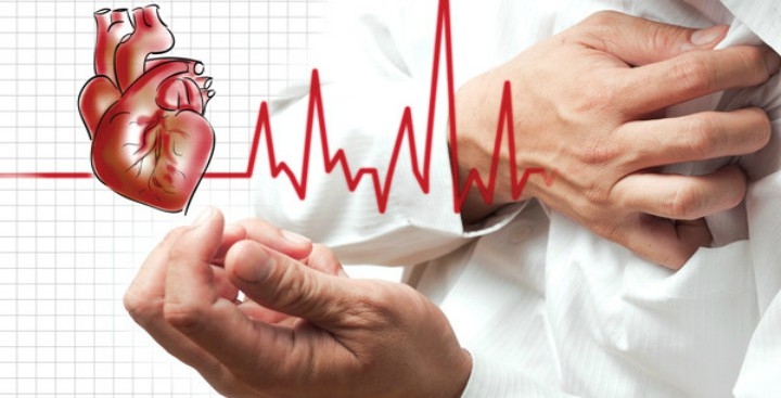 Khuyến cáo Hội chứng tim sau kỳ nghỉ lễ