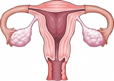 Suy buồng trứng sớm đe dọa chị em