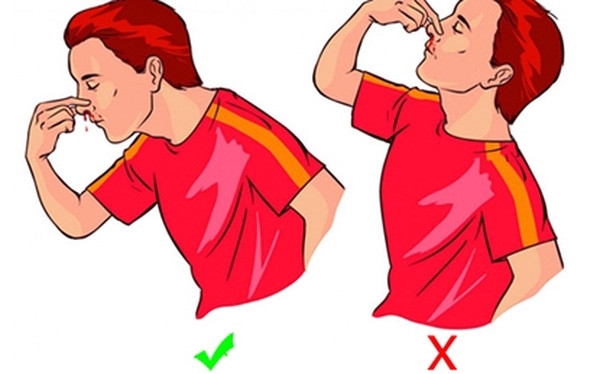 Nên và không nên làm gì khi trẻ chảy máu cam?