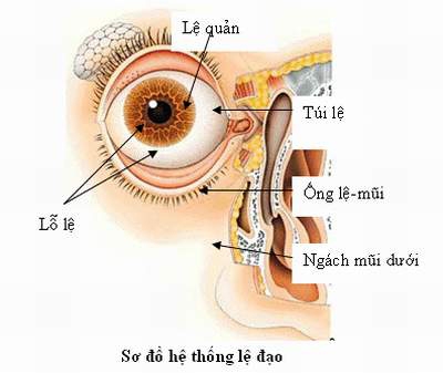 Chảy nước mắt sống và cách khắc phục