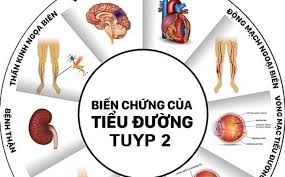 Giải cứu bàn chân đái tháo đường