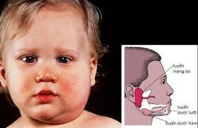 Nỗi sợ teo tinh hoàn sau quai bị