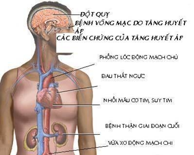 TĂNG HUYẾT ÁP “KẺ GIẾT NGƯỜI THẦM LẶNG”