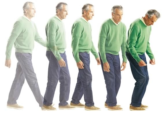 Tránh tàn phế do bệnh Parkinson, cách nào?