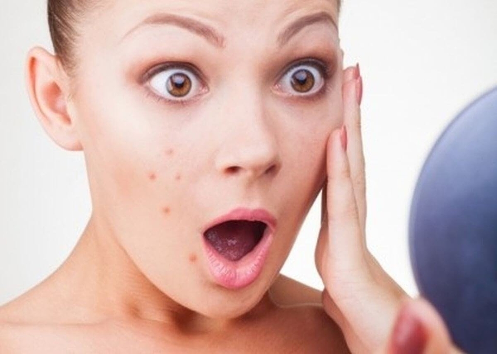 Dấu hiệu chứng tỏ bạn ăn quá nhiều đường