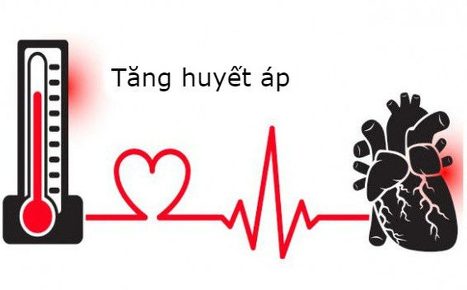 Nguy cơ đột quỵ ở người tăng huyết áp và cách sơ cứu