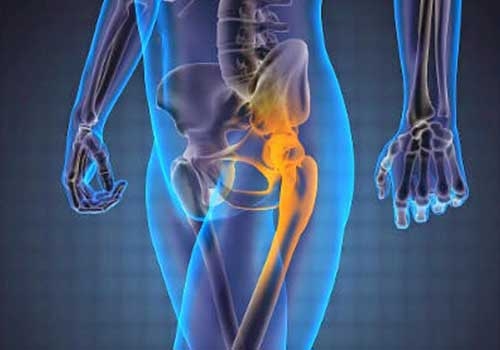 Cách trị đau khớp háng