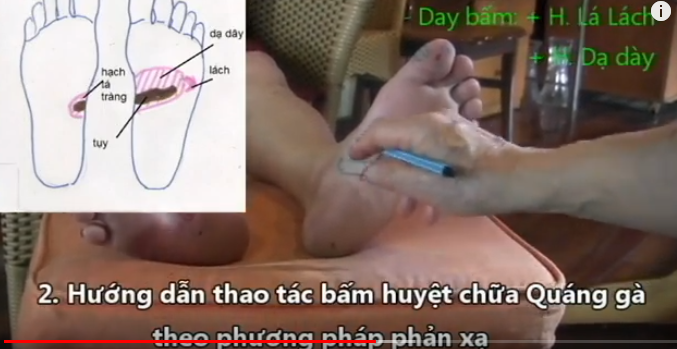 Bấm huyệt chữa MÙ MÀU - QUÁNG GÀ - ĐỤC THỦY TINH THỂ theo PP phản xạ - Thầy Lê Phương Cảo