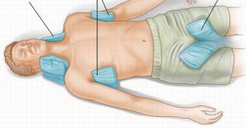 Kích thích sự hồi tỉnh khi bị say nắng nóng