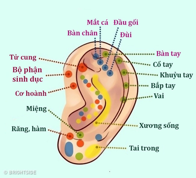 Nhĩ châm - phương pháp chữa bệnh độc đáo