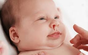 Món ăn - nước uống tốt cho người chảy máu cam