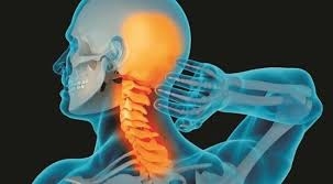 Thoái hóa đốt sống cổ cần điều trị sớm để tránh biến chứng nặng nề